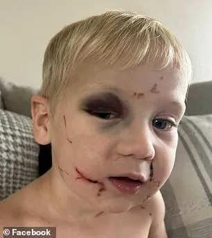 Georgia Daycare Worker Arrested on Child Abuse Charges After Allegedly Beating One-Year-Old Student