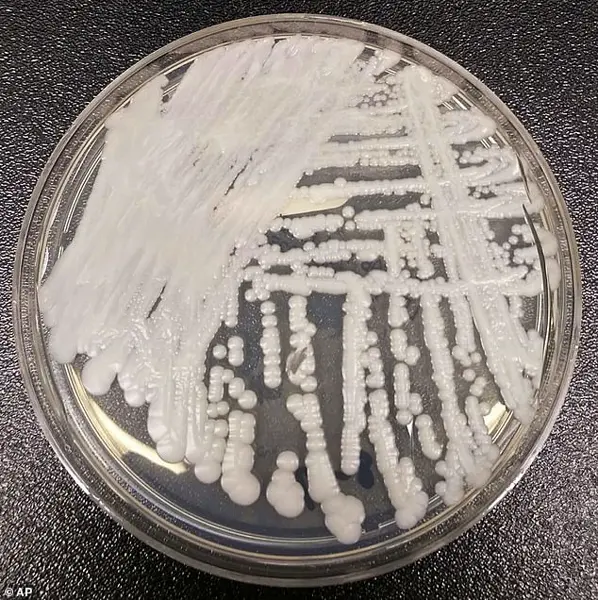 Urgent Alert: Candida Auris (C. Auris) Surges in U.S. Hospitals, CDC Warns of Expanding Public Health Crisis
