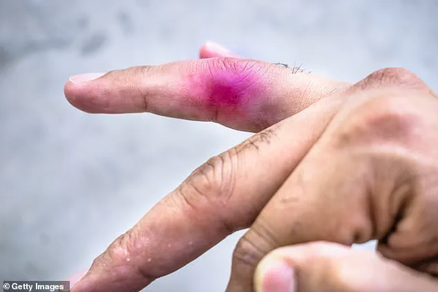 Nine-Year-Old Sues 11-Year-Old Peer Over Playground Scuffle Involving Toy Dinosaur That Nearly Severed Finger