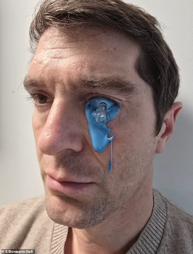 Breaking: Fox News Correspondent Shares Graphic Image of Ongoing Recovery from Ukraine War Injuries