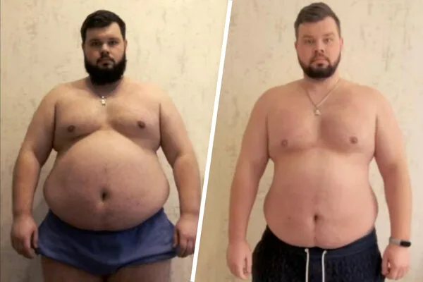 Forced Conscription of Obese Man with Chronic Illness Sparks Controversy in Ukraine