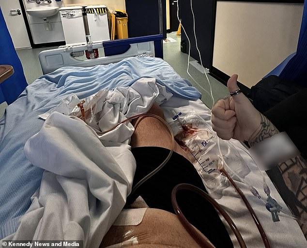 Man Warns After Losing Weight on Mounjaro Then Dying of Gallbladder Infection