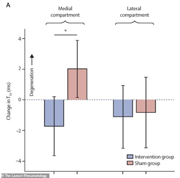 Stanford Study: Simple Foot Angle Shifts Could Ease Knee Osteoarthritis Pain