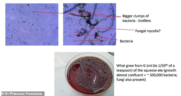 Kitchen sponges release far more microplastics than dishwashers, study finds.