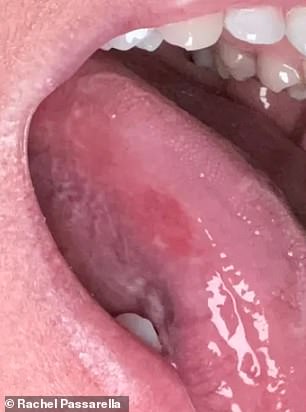 Florida Nurse Prone Dismissed Fatal Tongue Cancer Until Stage Four Diagnosis