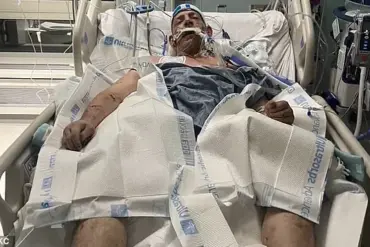 Tragic Incident in Kansas City: Man Killed in 23-Minute Pit Bull Attack