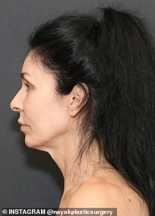 Kelly's Self-Reflection Leads to Transformation, as Dr. Nayak Navigates Nervousness in Their Longstanding Partnership