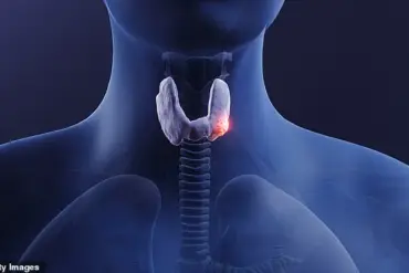 Misdiagnosis and the Hidden Burden of Thyroid Cancer: A Call for Better Healthcare Awareness