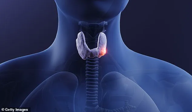 Misdiagnosis and the Hidden Burden of Thyroid Cancer: A Call for Better Healthcare Awareness